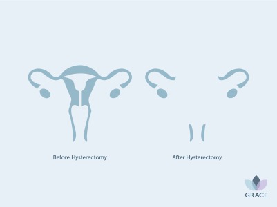 GR - Hysterectomy